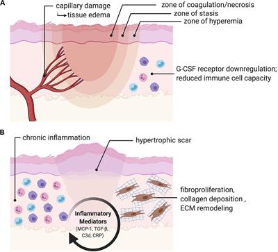 Current and Emerging Topical Scar Mitigation Therapies for Craniofacial Burn Wound Healing